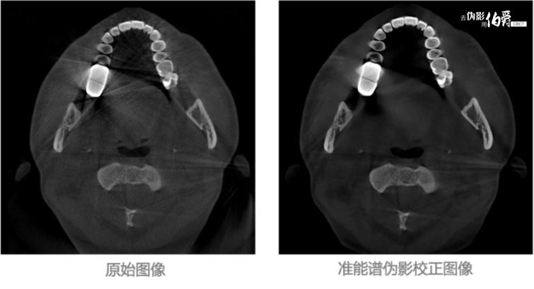 伯爵CBCT