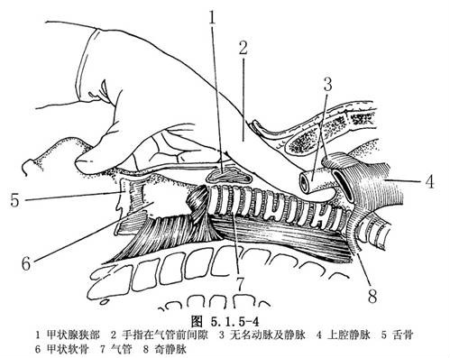 頸縱隔鏡檢查術