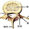 脊柱破壞