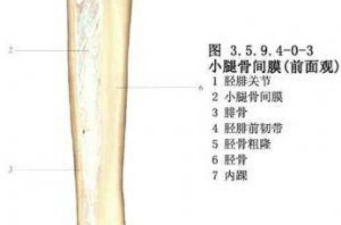 脛骨幹骨折螺絲釘內固定術 麻醉方式 術前準備及術前注意 適應證 禁忌證 手術步驟 中文百科全書