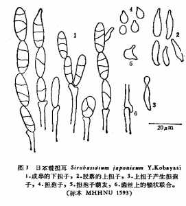 日本鏈擔耳