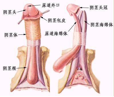 佩羅尼病