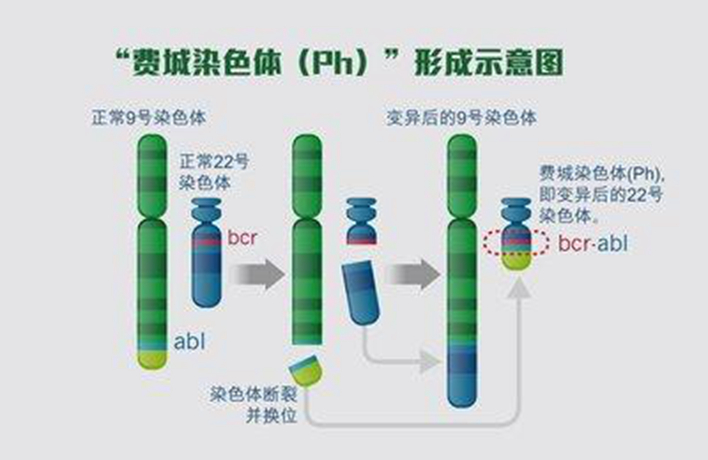 費城染色體(ph染色體)