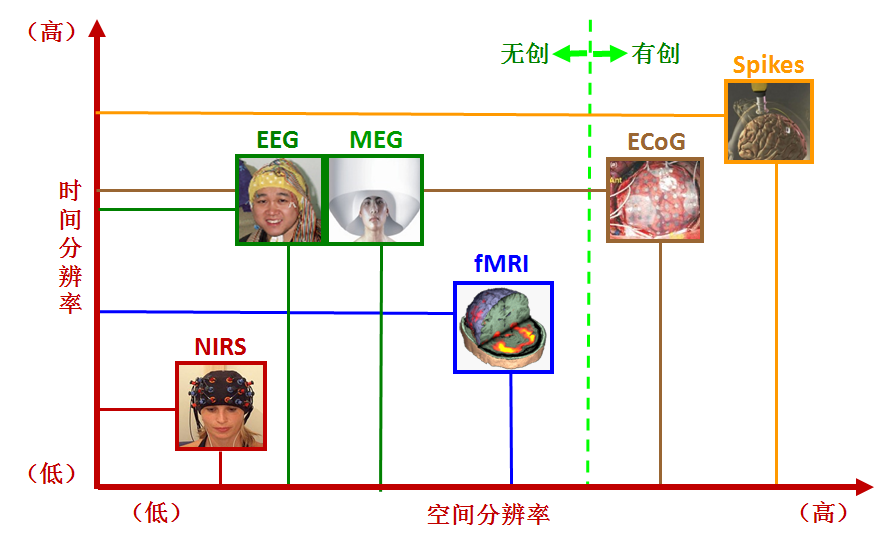 神經影像學