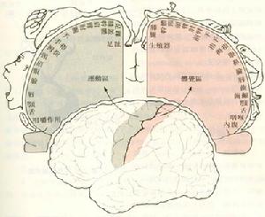 耳塞機綜合症