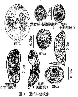 並殖吸蟲屬