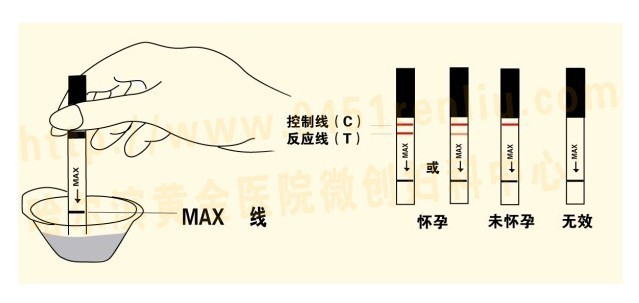 妊娠診斷試紙