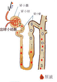 遠端型腎小管酸中毒