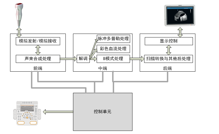 B型超聲