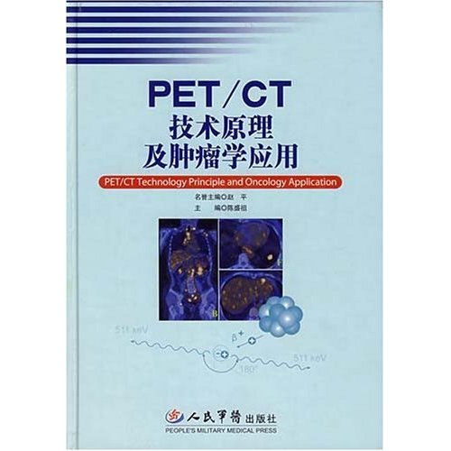 PET/CT技術原理及腫瘤學套用