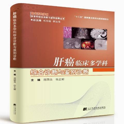 肝癌臨床多學科綜合診斷與鑑別診斷