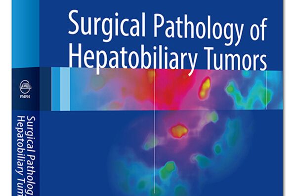 肝膽腫瘤外科病理學（英文版）