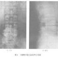 懼站立，喜依託