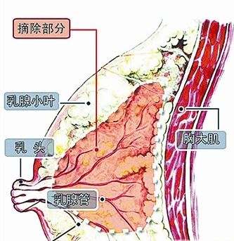 BRCA1基因