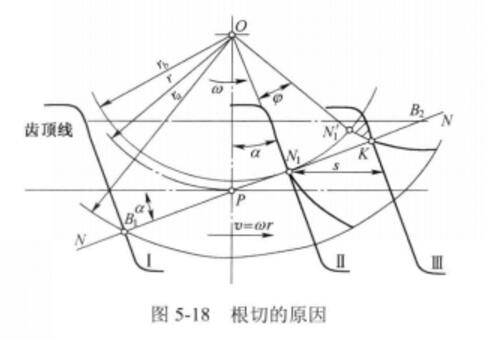 根切原因