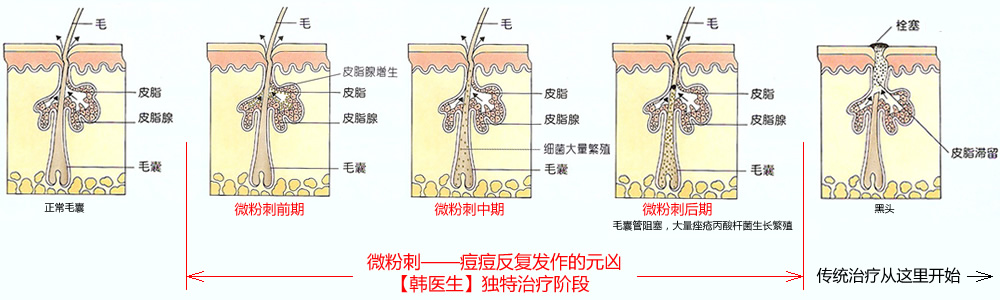 南昌韓醫生專業祛痘連鎖機構