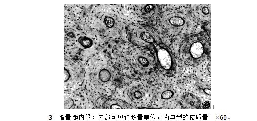 股骨距內段