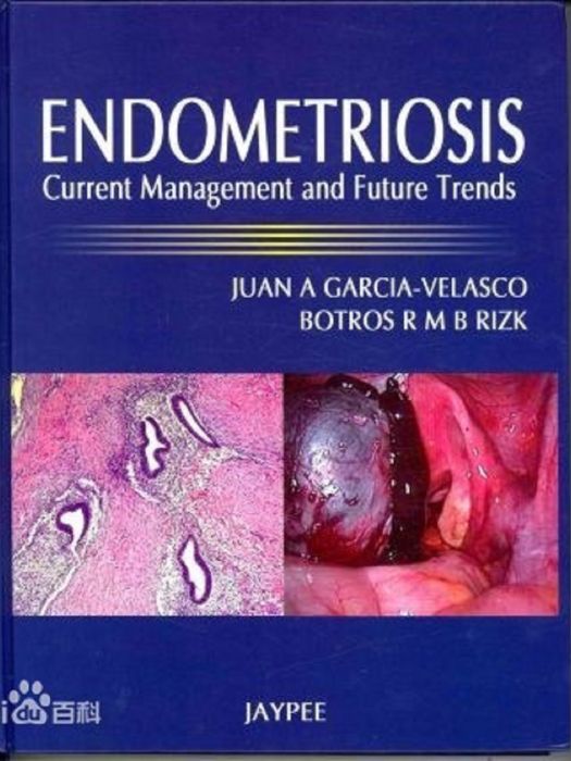 Endometriosis Current Management and Future Trends