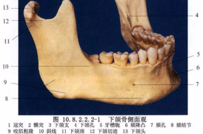 下頜體後部截骨術