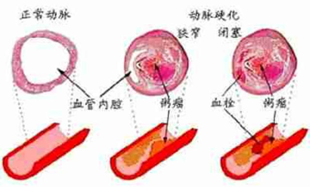 三、腦的發生