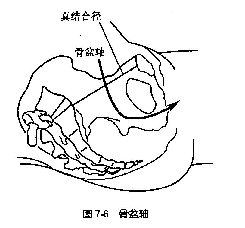 女性骨盆