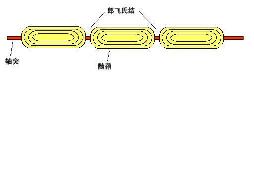 郎飛氏結