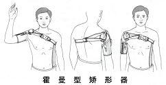 霍曼型矯形器