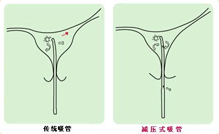 比較