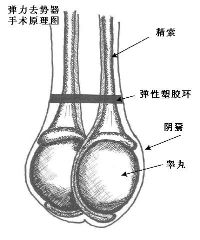 彈力去勢器手術原理圖