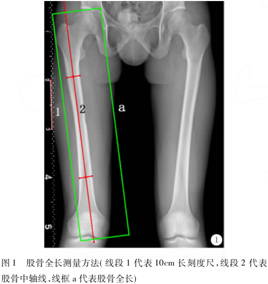 下肢全長