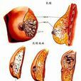 乳腺通絡散