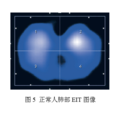 生物電阻抗斷層成像