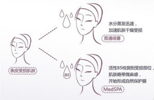 MedSPA溫泉B5舒緩噴霧