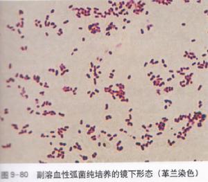 副溶血弧菌食物中毒