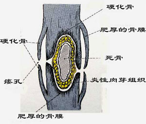 小諾黴素