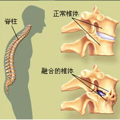 對比圖片