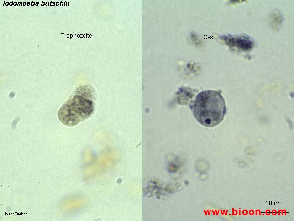 布氏嗜碘阿米巴包囊及滋養體（蘇木素染色）