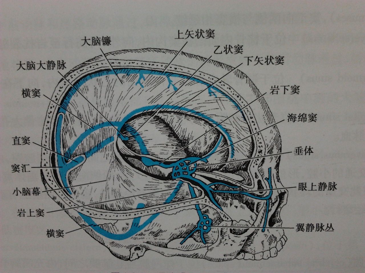 橫竇