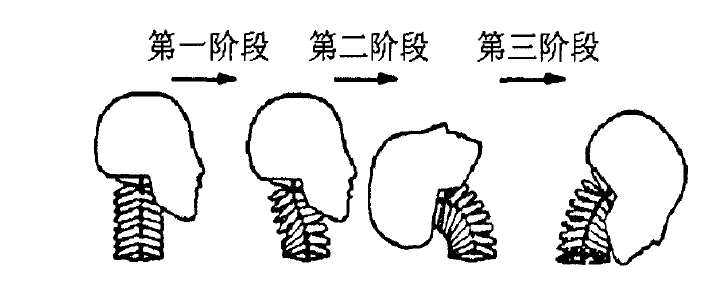 揮鞭傷