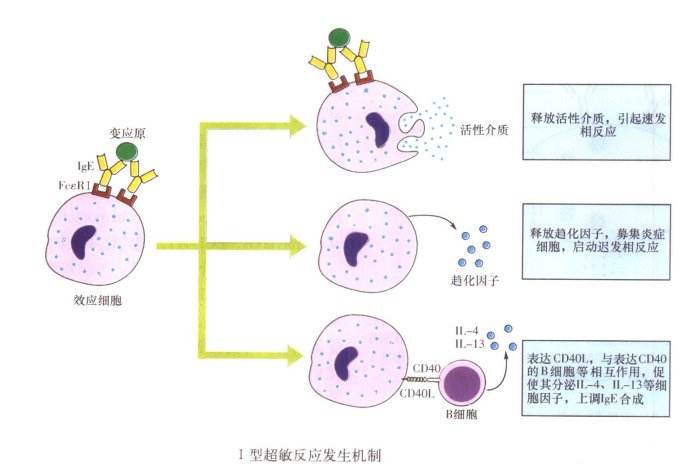 Ⅰ型超敏反應(Ⅰ型超敏反應)