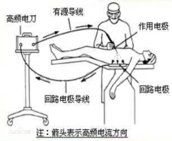 工作原理示意圖