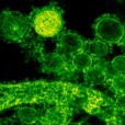 中東呼吸系統綜合徵冠狀病毒(MERS-CoV)