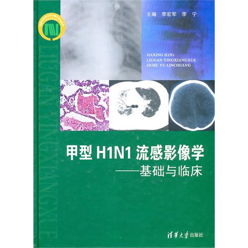 甲型H1N1流感影像學