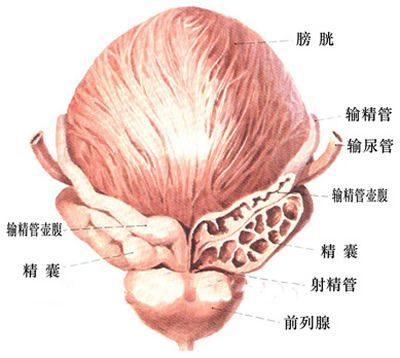 精囊炎性不育