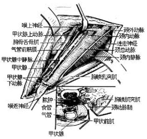 經頸結核病灶清除術