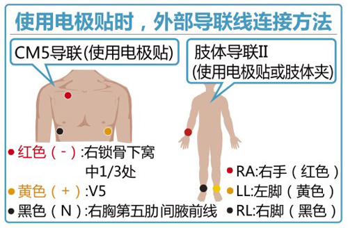 電極貼導聯線測量方法