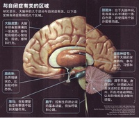 邊緣性自閉症