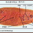 布氏薑片吸蟲