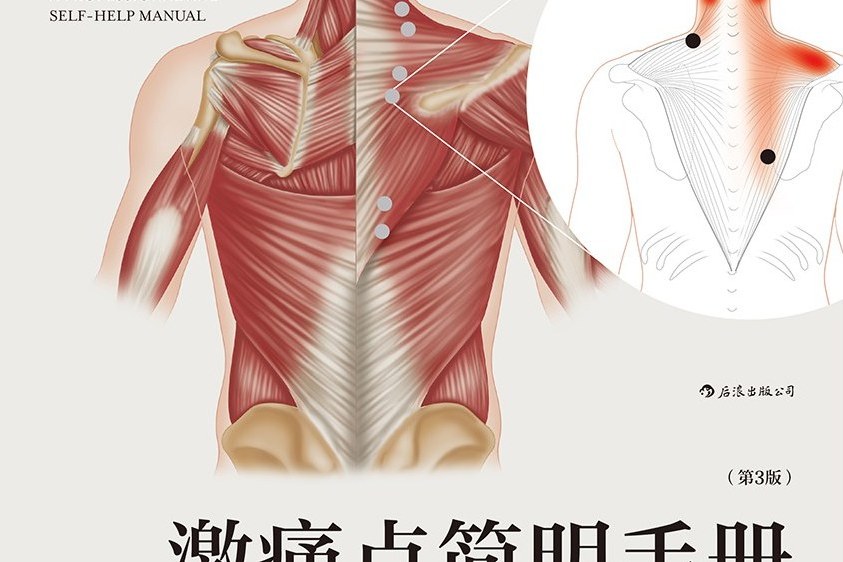 激痛點簡明手冊