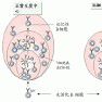 嚴重聯合免疫缺陷病